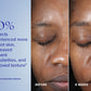 Active Peel System