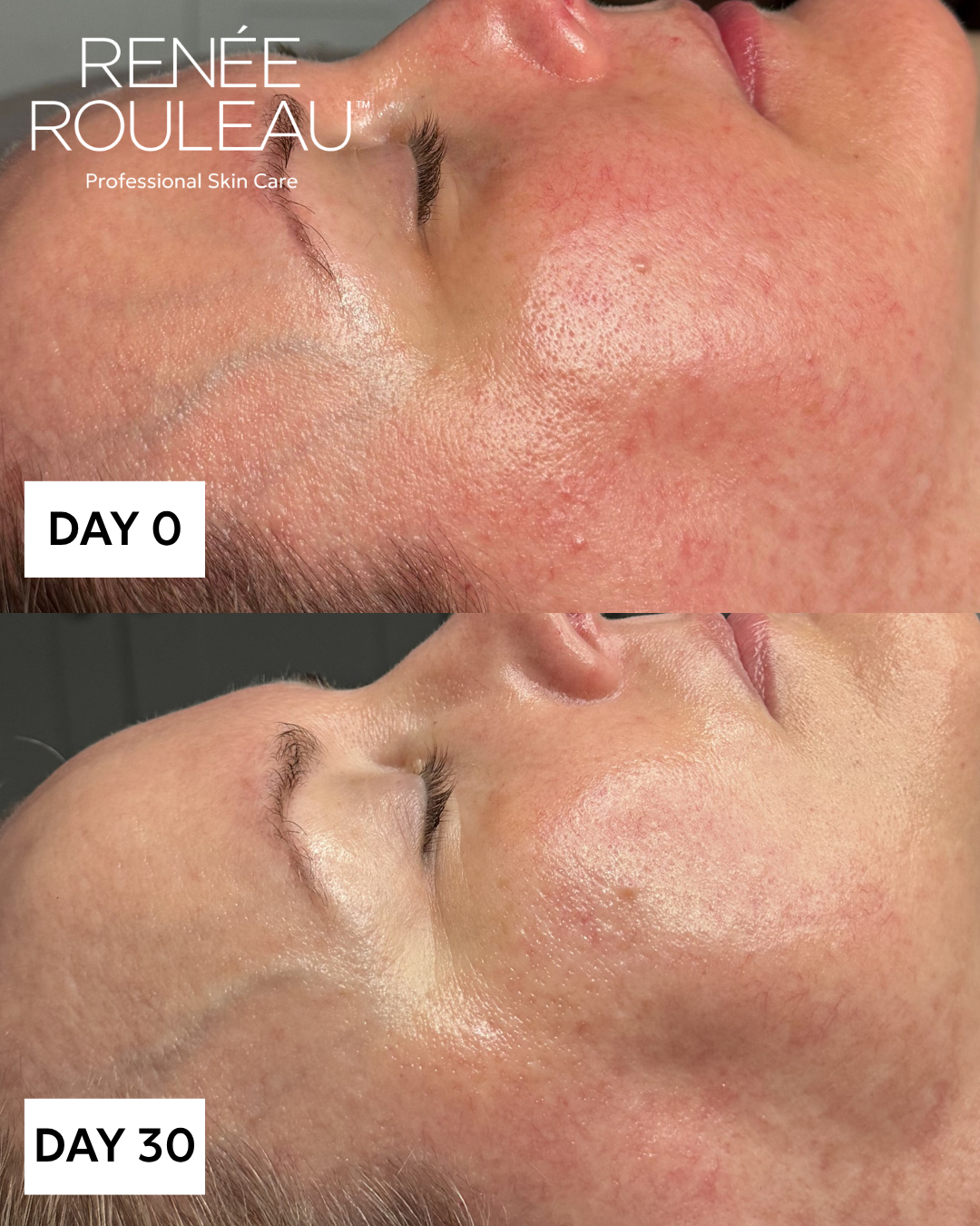 Skin Drink IV