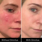 Omnilux Contour Face