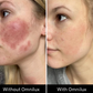 Omnilux Contour Face