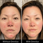 Omnilux Contour Face