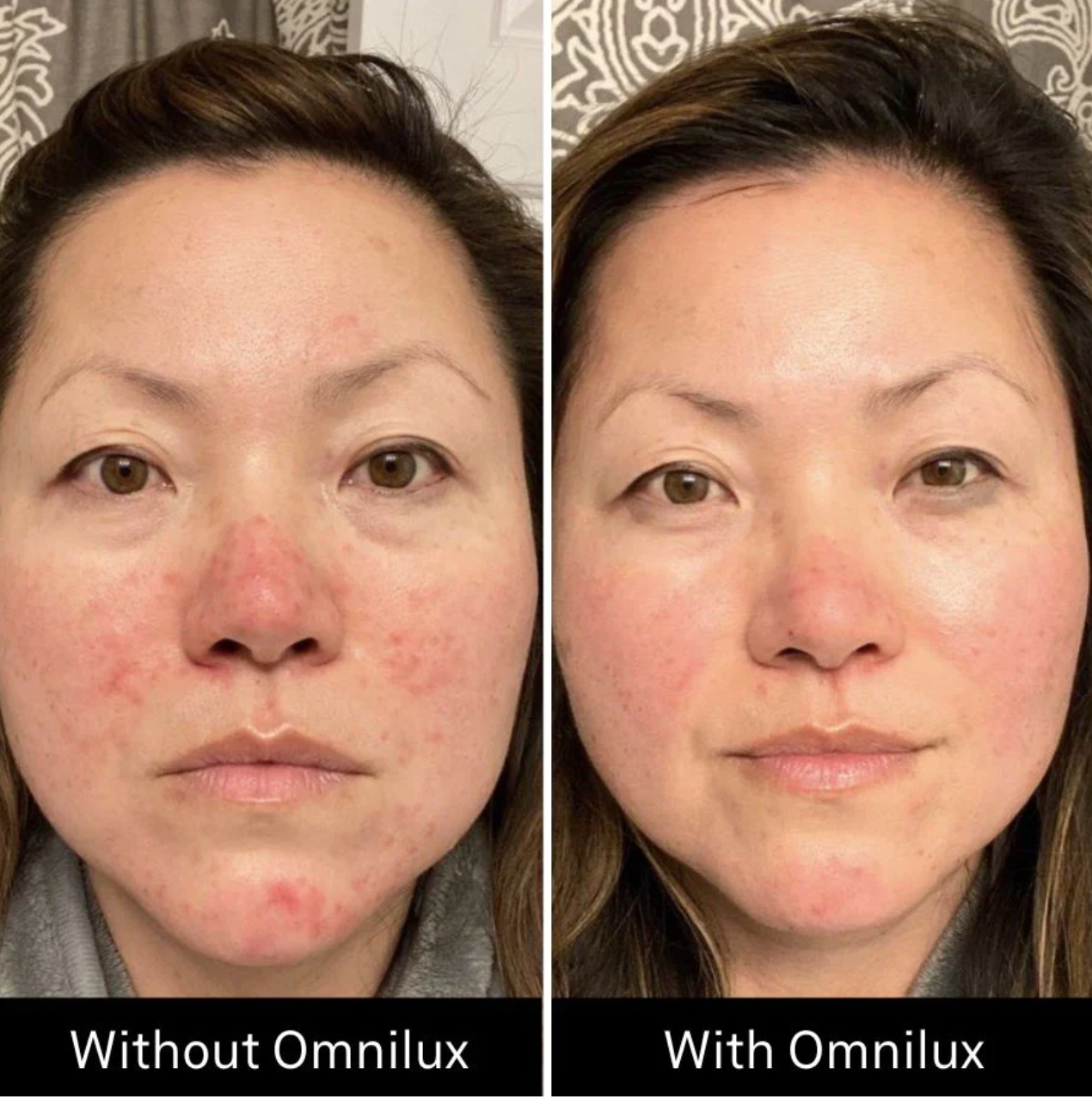 Omnilux Contour Face