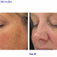 Brightening Complex