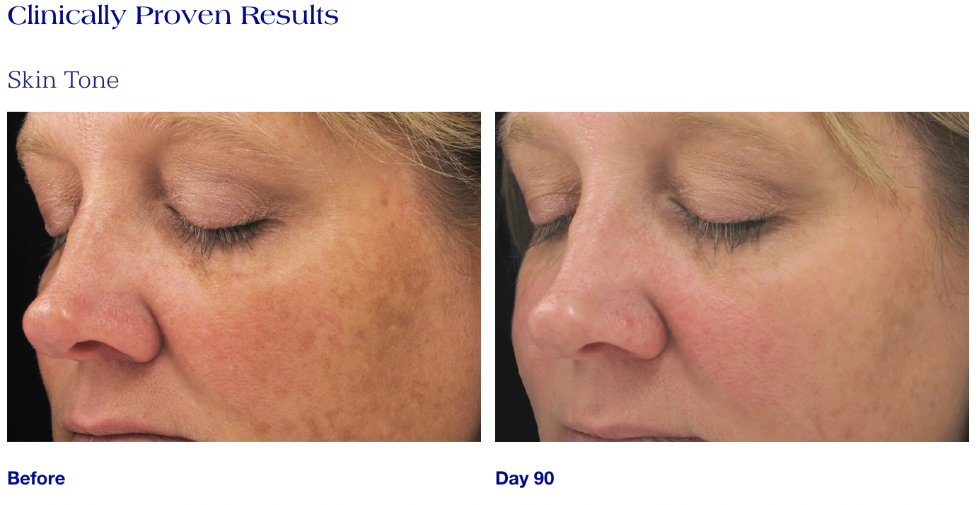 Brightening Complex