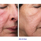 Retinol+ Emulsion 0.3
