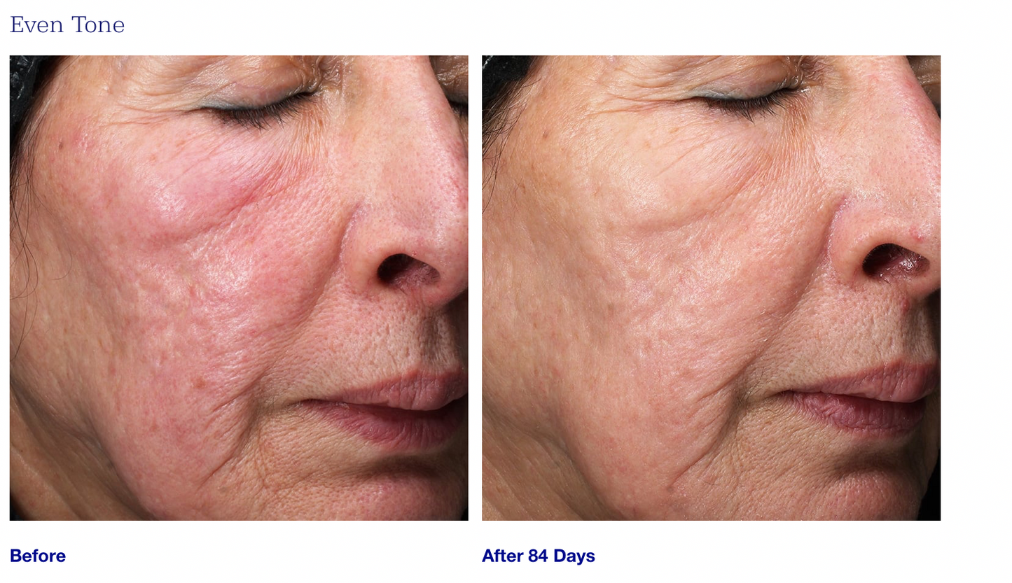 Retinol+ Emulsion 0.3
