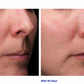 Retinol+ Emulsion 0.3