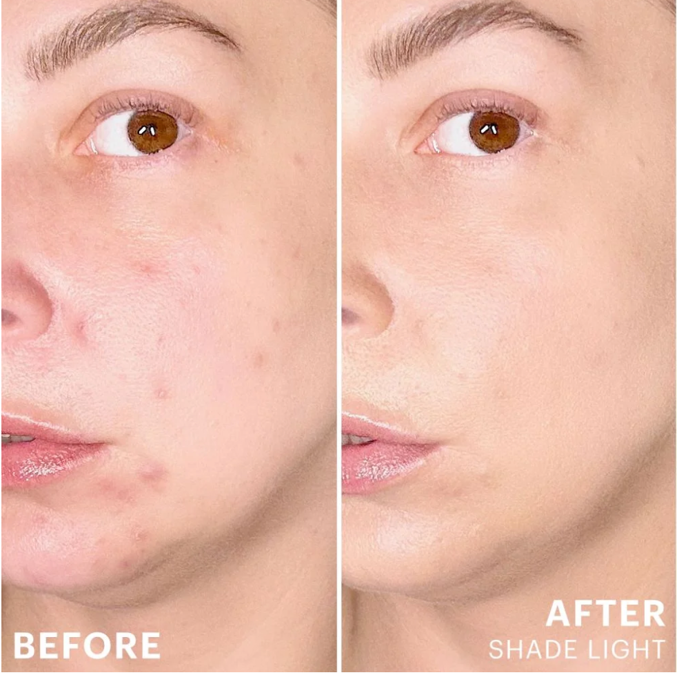 Glo Skin Beauty Spot Treat Concealer is a long-wearing acne concealer with 1% salicylic acid that conceals blemishes while supporting clearer-looking skin at The Skyn Distillery Wayzata MN.