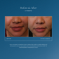 Before and after results using iS Clinical Daily Dynamic Hydrator 3-in-1 moisturizer with vitamin C and peptides to brighten, smooth texture, and hydrate skin at The Skyn Distillery Wayzata Minnesota