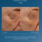 Before and after showing hydration, glow, and improved fine lines with iS Clinical Daily Dynamic Hydrator 3-in-1 vitamin C peptide moisturizer at The Skyn Distillery in Wayzata MN
